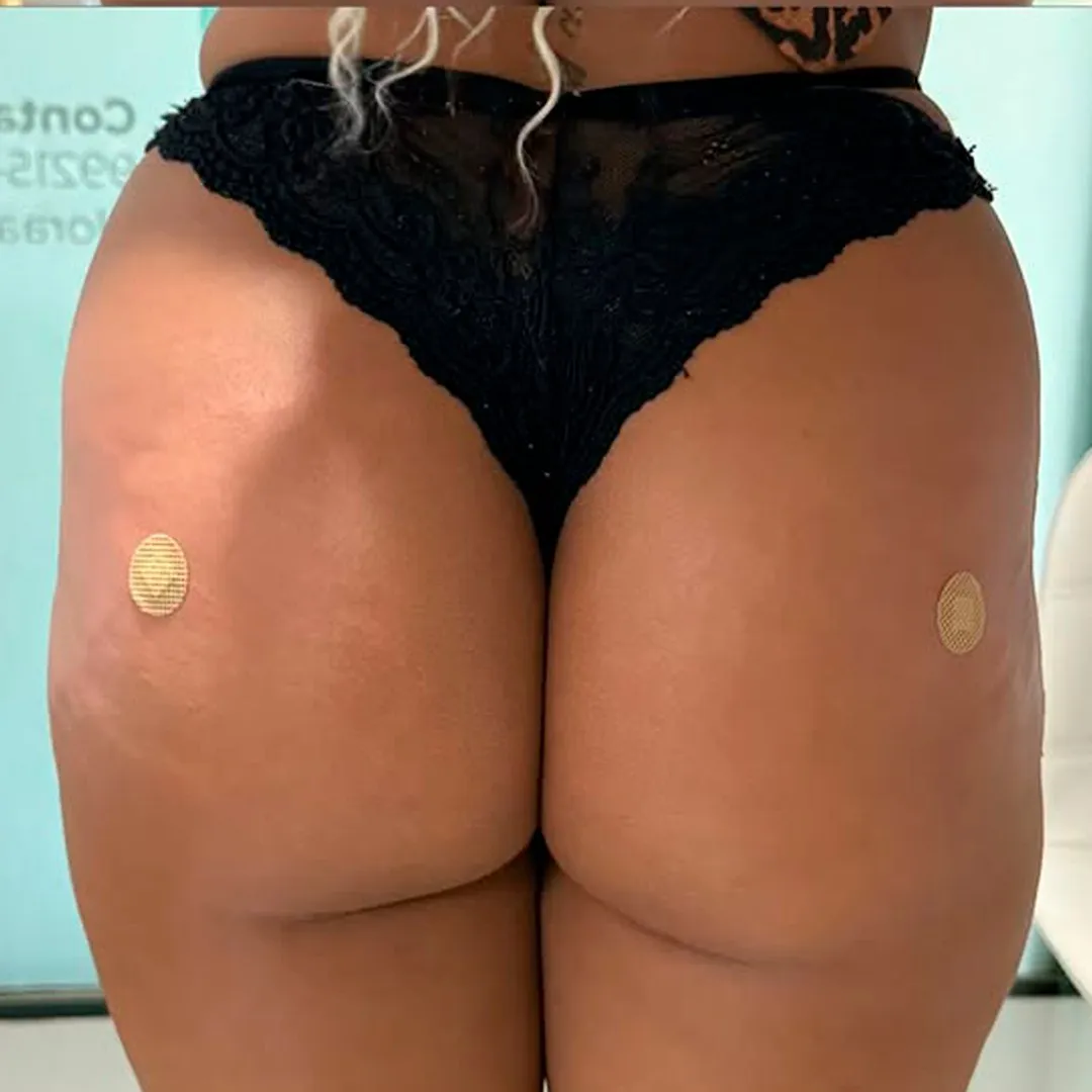 Depois